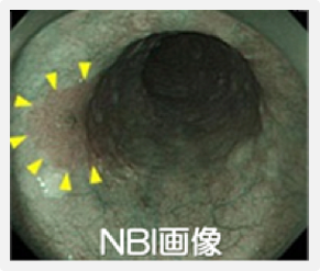 胃内視鏡検査